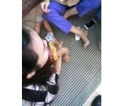 Toàn cảnh vụ bé 15 tháng tuổi bị 